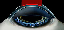 Eye Image